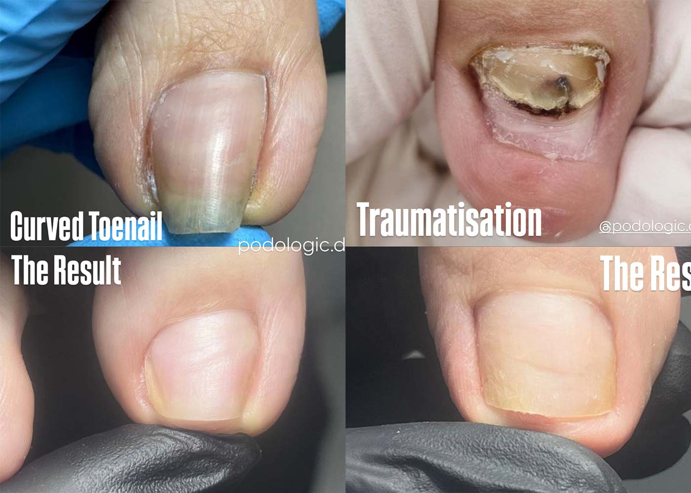 Top Benefits of Cosmetic Podology in Dubai