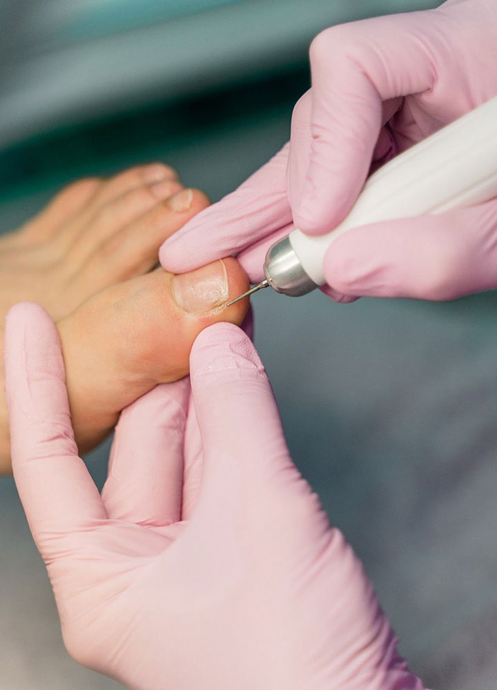 Podology image by PodoLogic